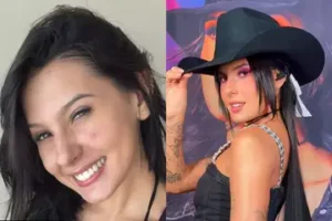 Ana Castela abre o jogo sobre acne e diz que mudou de vida; veja o que ela disse